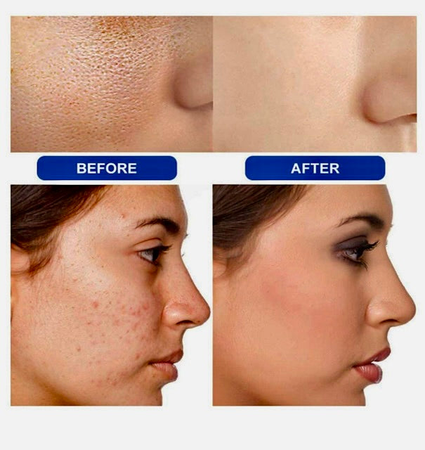 Hyaluron Serum Gesicht ,Skincare Anti Aging Serum mit 24K Echtgoldpartikel, Niacinamide Essence,Strahlender Glow 100ml